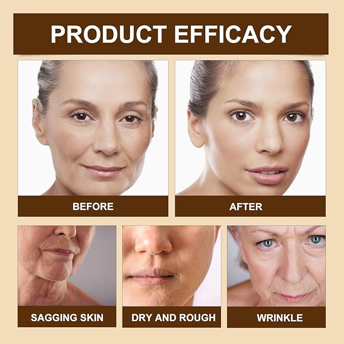 Crema Lifting De Veneno De Abeja Botox