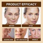 Crema Lifting De Veneno De Abeja Botox