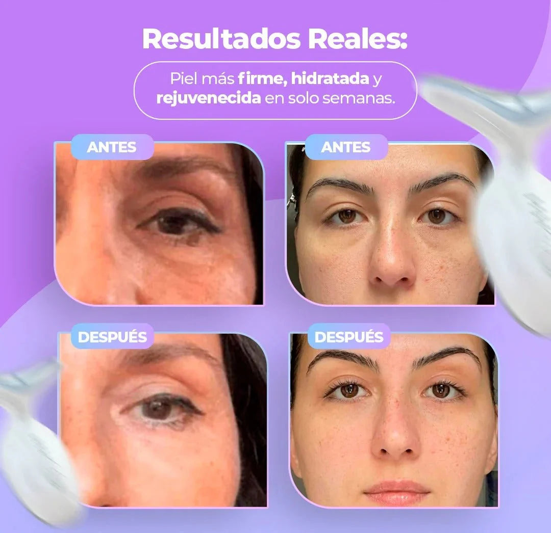 Masajeador Facial antiarrugas
