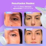 Masajeador Facial antiarrugas